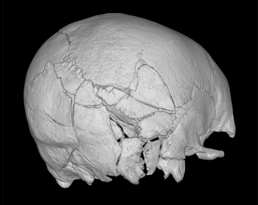 3D model from CT scan of reconstructed skull of Skeleton 150
