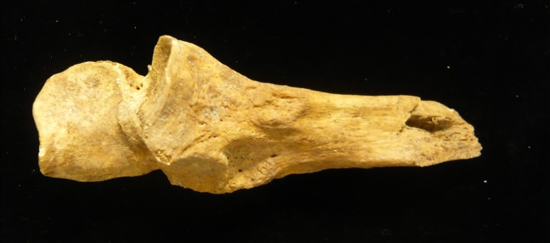 Forearm bone against a black background.