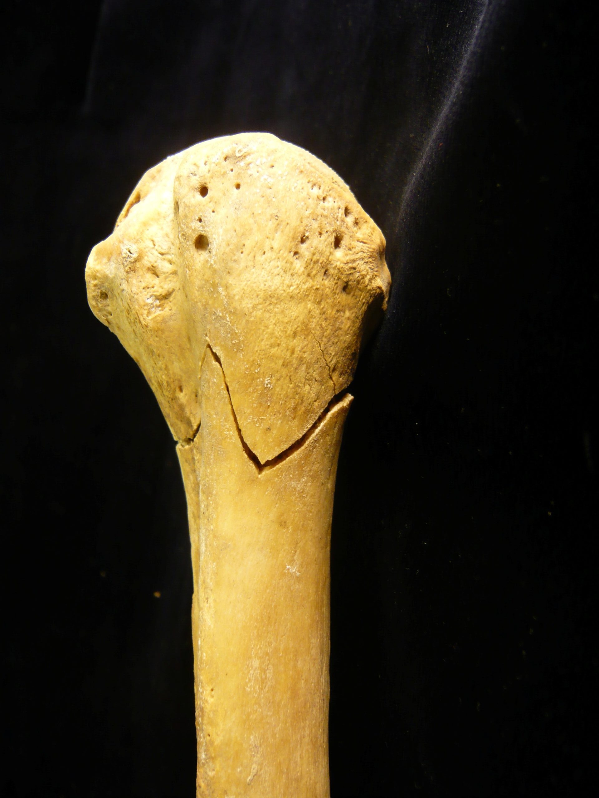 Bone showing zigzag fracture.