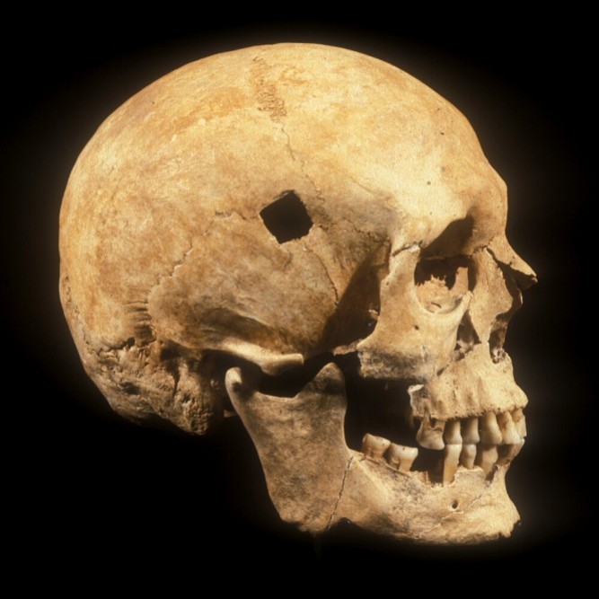Skull against a black background with a square hole in it. 